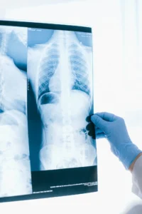 MRI-בטן