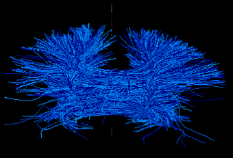 Read more about the article איך מרגישים אחרי בדיקת MRI?