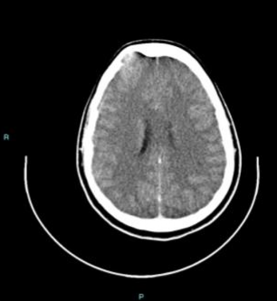 Read more about the article מקרה בוחן – התקף אפילפסיה ראשון בחיים